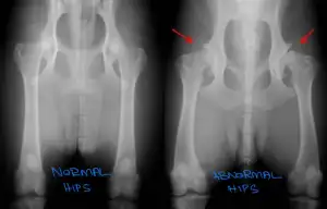 Hip Dysplasia